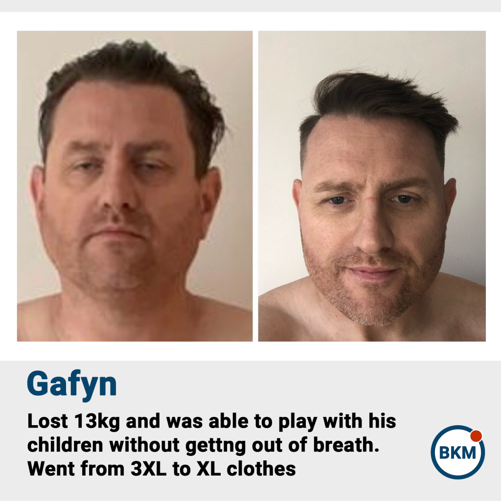 Gafyn before and after fat loss